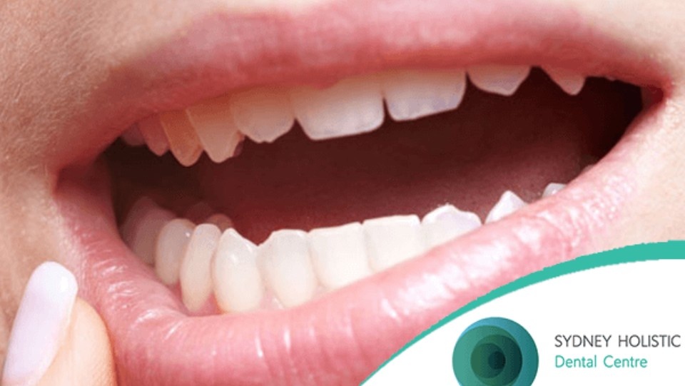 Close up of a person pointing to their gums