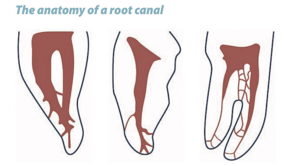 the anatomy of a root canal