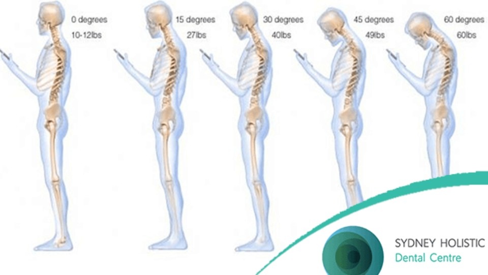 neck posture chart