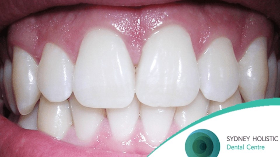 healthy smile