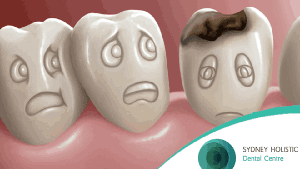 tooth decay